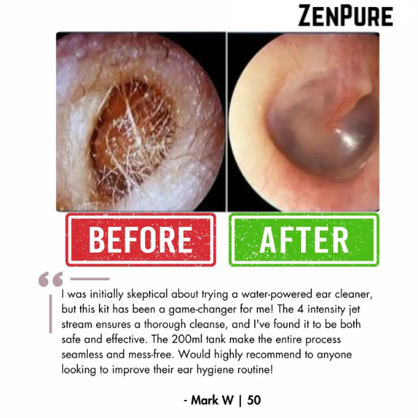 ZenPure™ Electric Ear Wax Removal Kit