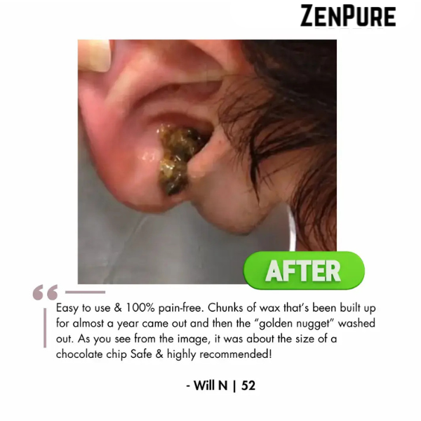 ZenPure™ Electric Ear Wax Removal Kit