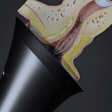 ZenPure™ Electric Ear Wax Removal Kit